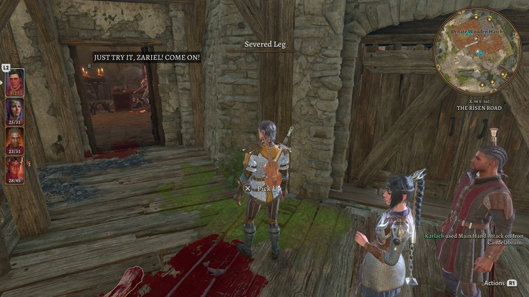 Baldur's Gate III finding a severed leg on the ground.